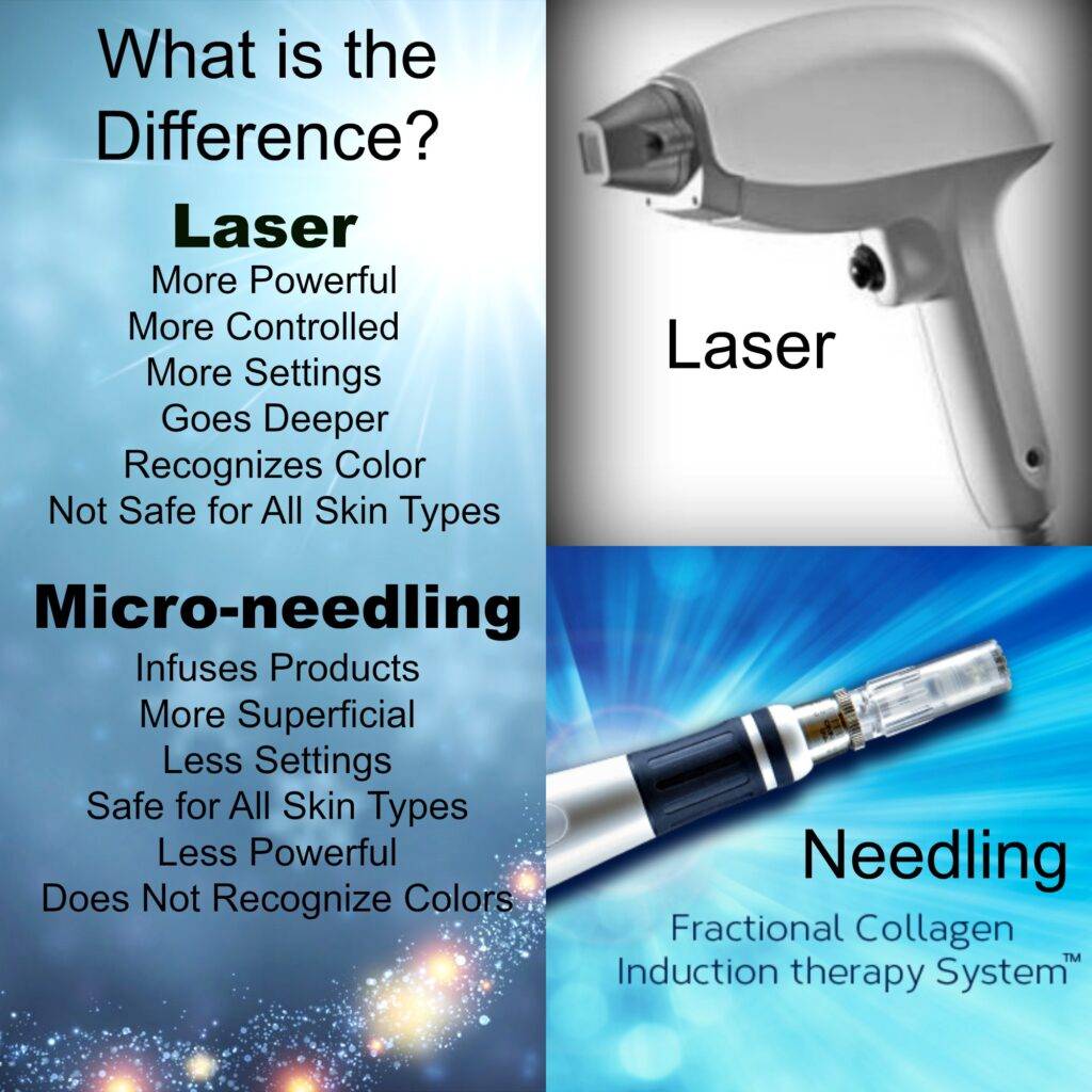 Is RF Microneedling Better Than Laser?