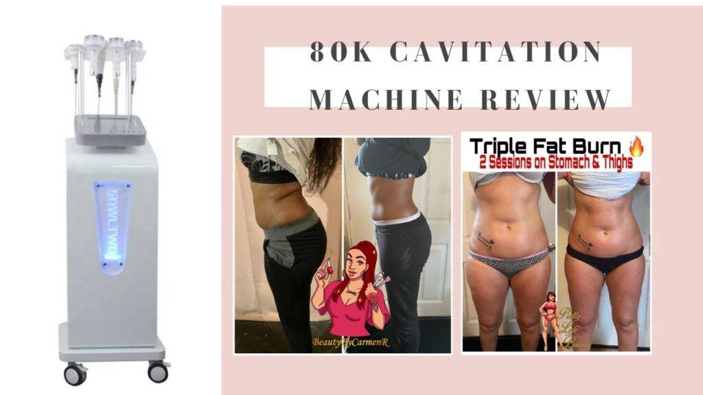 80K Cavitation Machine Vs 40K Cavitation
