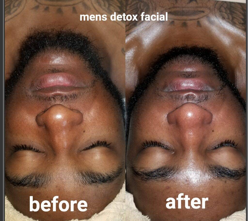 What Does a Men’S Facial Do?