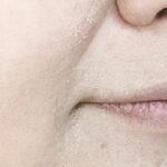 How to Fix Makeup on Dry Skin?