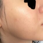 Does Bb Cream Clog Pores