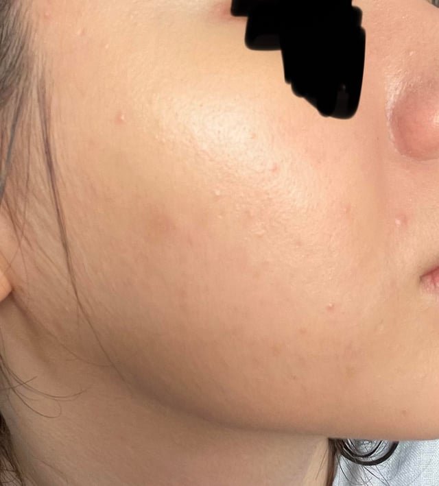 Does Bb Cream Clog Pores