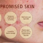 Understanding Barrier Repair And Its Skin Benefits