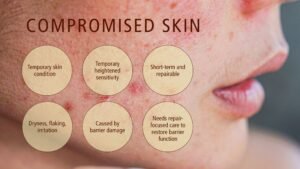 Understanding Barrier Repair And Its Skin Benefits