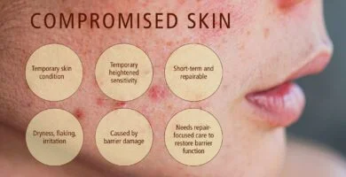 Understanding Barrier Repair And Its Skin Benefits