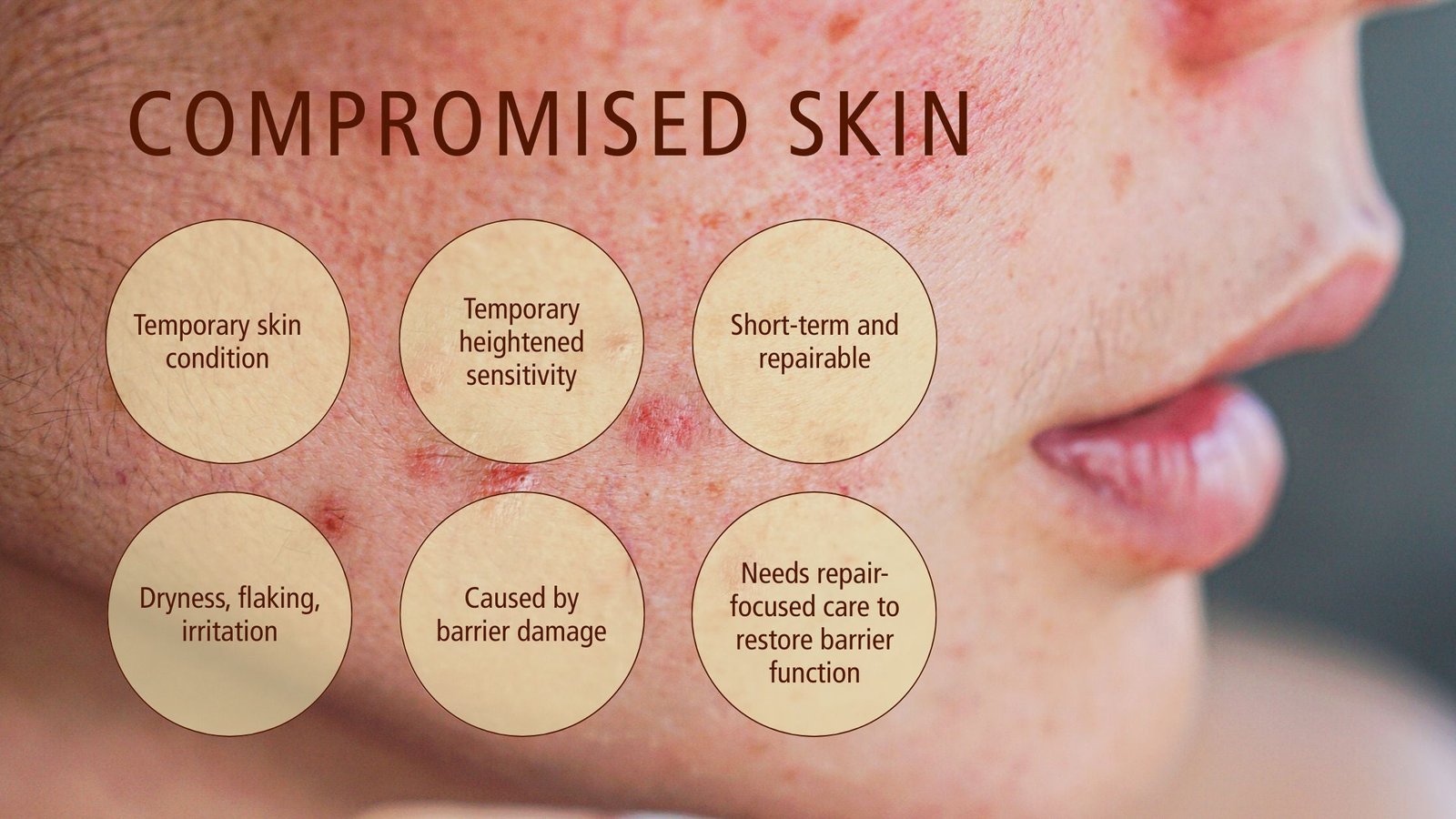 Understanding Barrier Repair And Its Skin Benefits