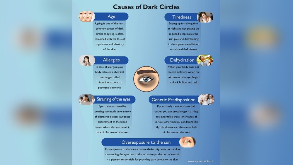 Can Dehydration Cause Dark Circles