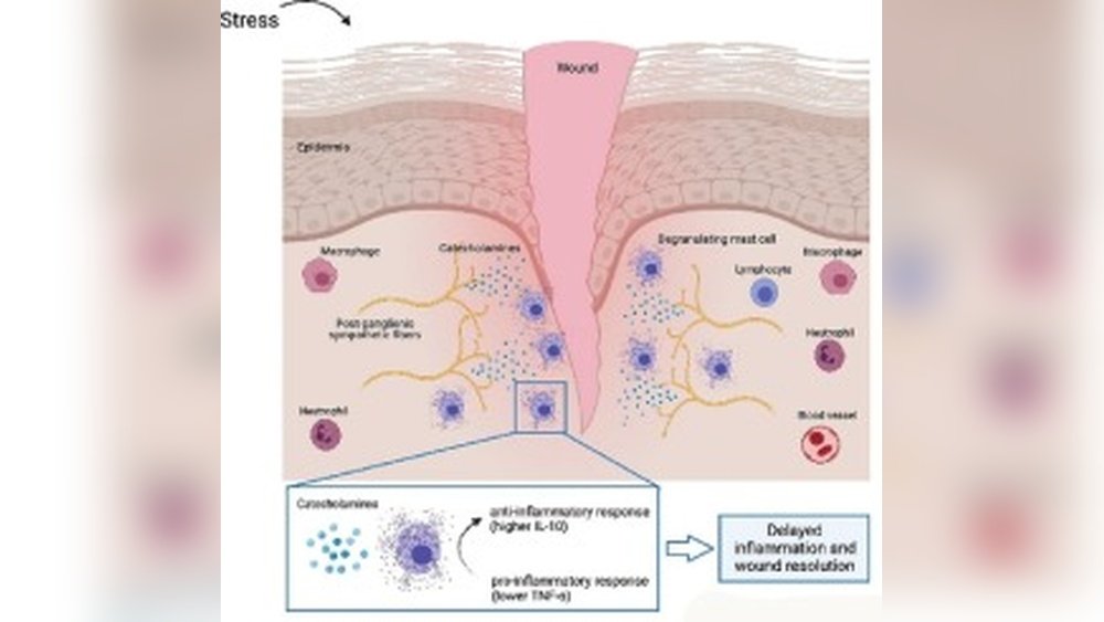Can Stress Delay Skin Healing