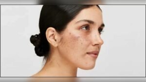 Can Vitamin Deficiency Cause Dull Face