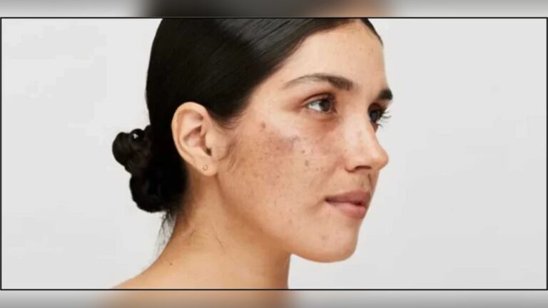 Can Vitamin Deficiency Cause Dull Face