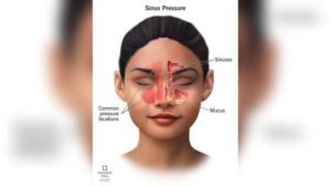 Connection between Sinuses And Facial Pressure