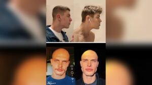 Does Chewing Gum Tone Facial Muscles