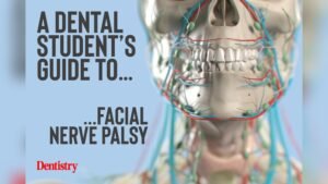 Facial Numbness After Nerve Block Or Dental Work