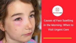 Facial Swelling in Morning Reasons