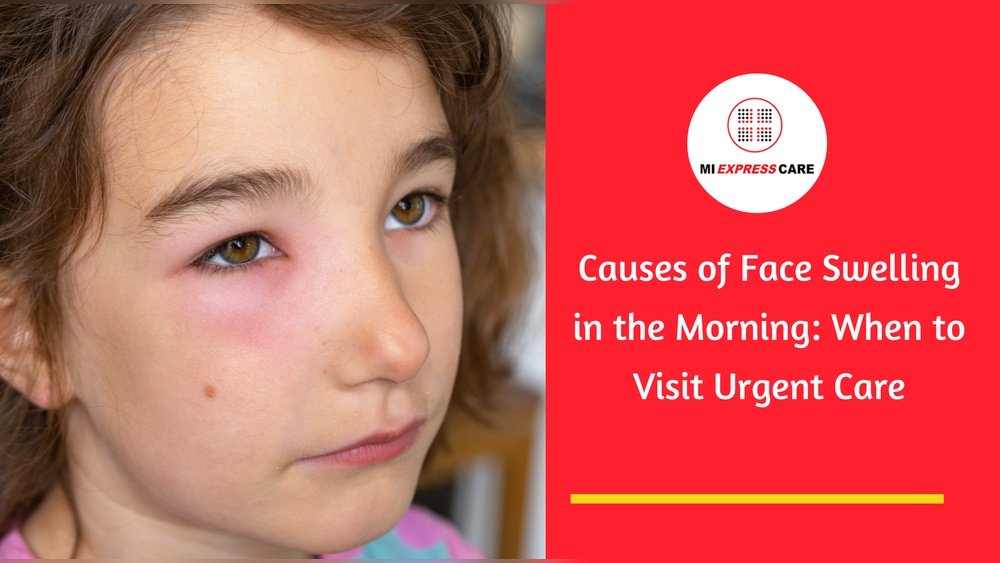 Facial Swelling in Morning Reasons