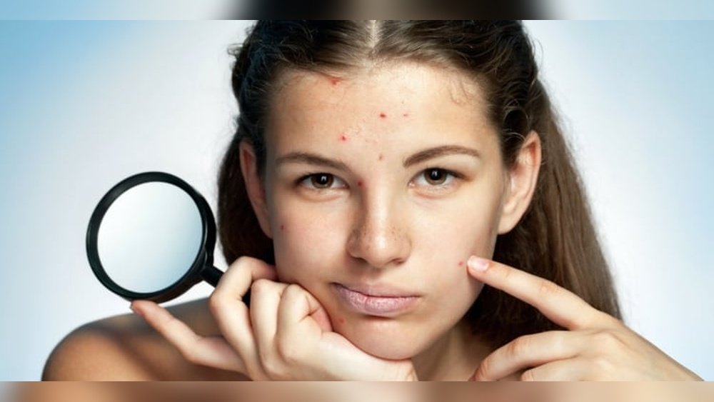 Hormonal Facial Skin Changes During Cycle