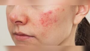 How Alcohol Affects Facial Skin Overnight