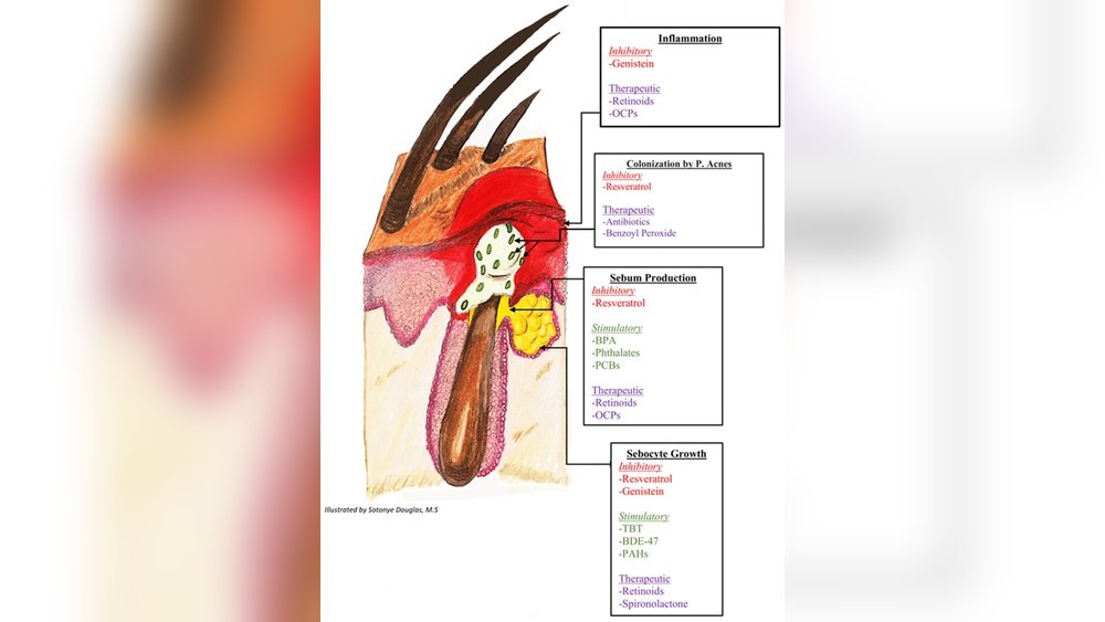 How Hormones Affect Sebum Production