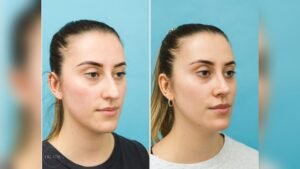 How Sleep Stages Affect Facial Circulation