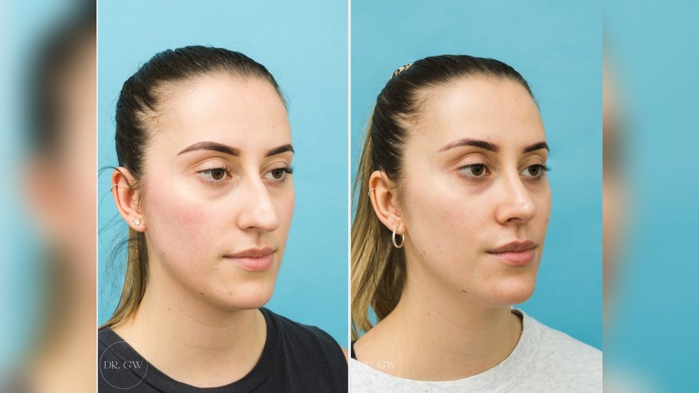 How Sleep Stages Affect Facial Circulation