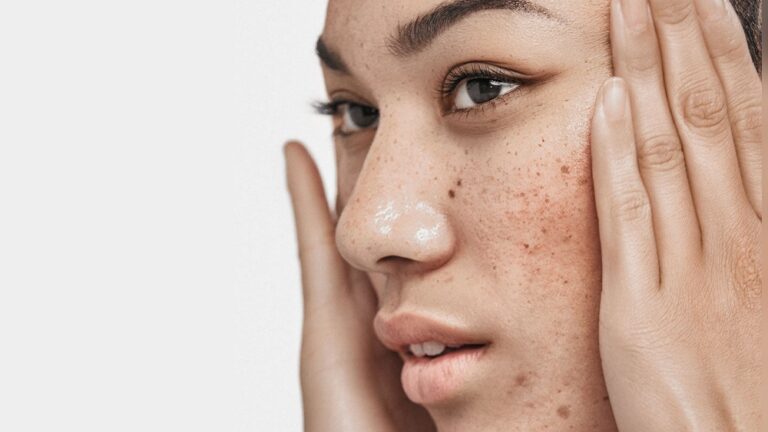 How Stress Manifests on Facial Skin