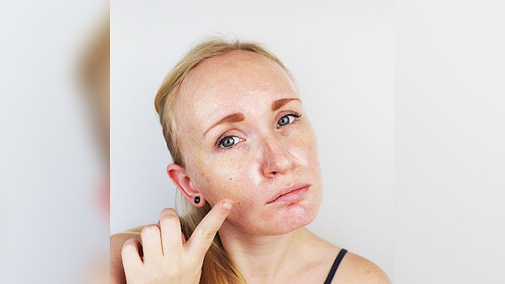 How to Fix Greasy Feeling After Skincare