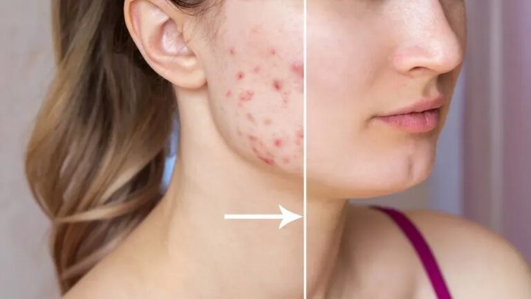 How to Make Lipstick Last Longer Chemically