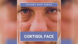 How to Reduce Cortisol for Better Skin