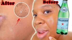 Is Mineral Water Good for Skin