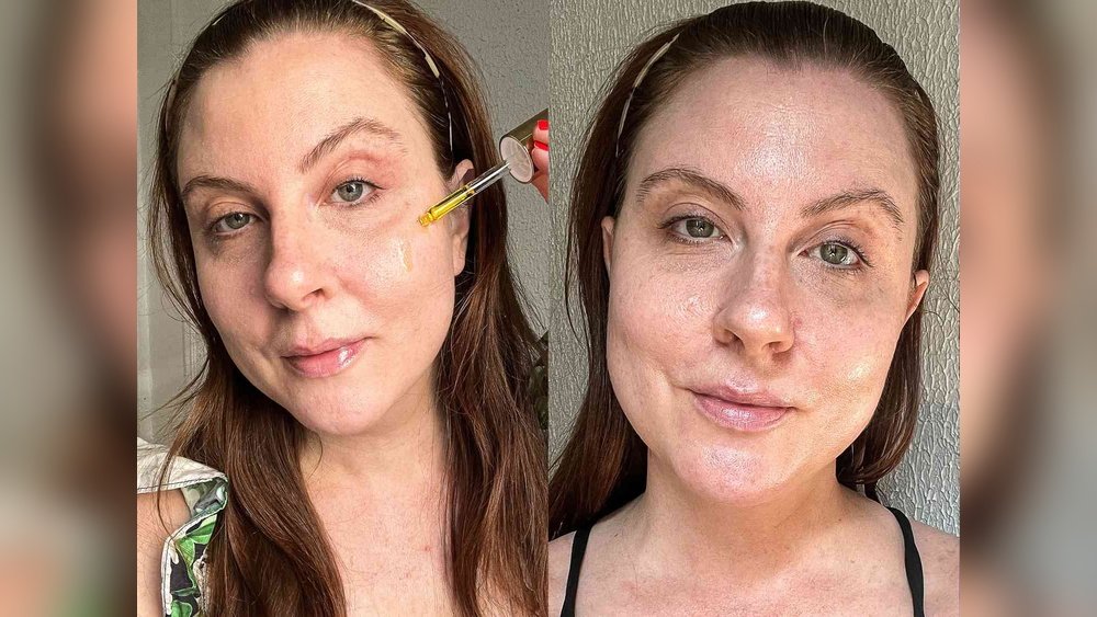 Oily T Zone But Dry Cheeks Fix