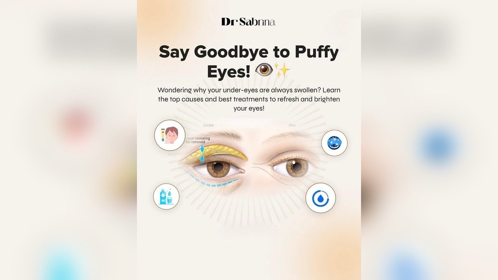 Puffiness under Eyes After Salt Intake