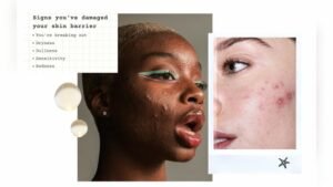 Sensitive Skin Barrier Damaged Signs