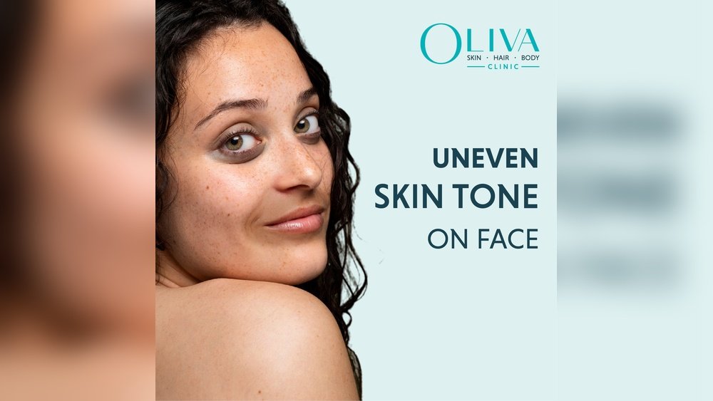 Uneven Skin Texture on Cheeks Causes