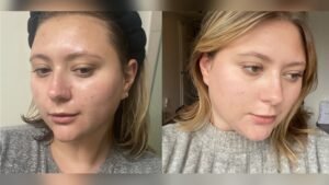 What is Slugging in Skincare