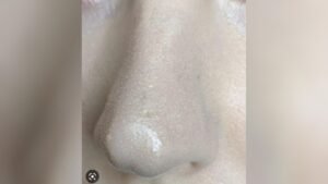 Why Makeup Settles in Pores