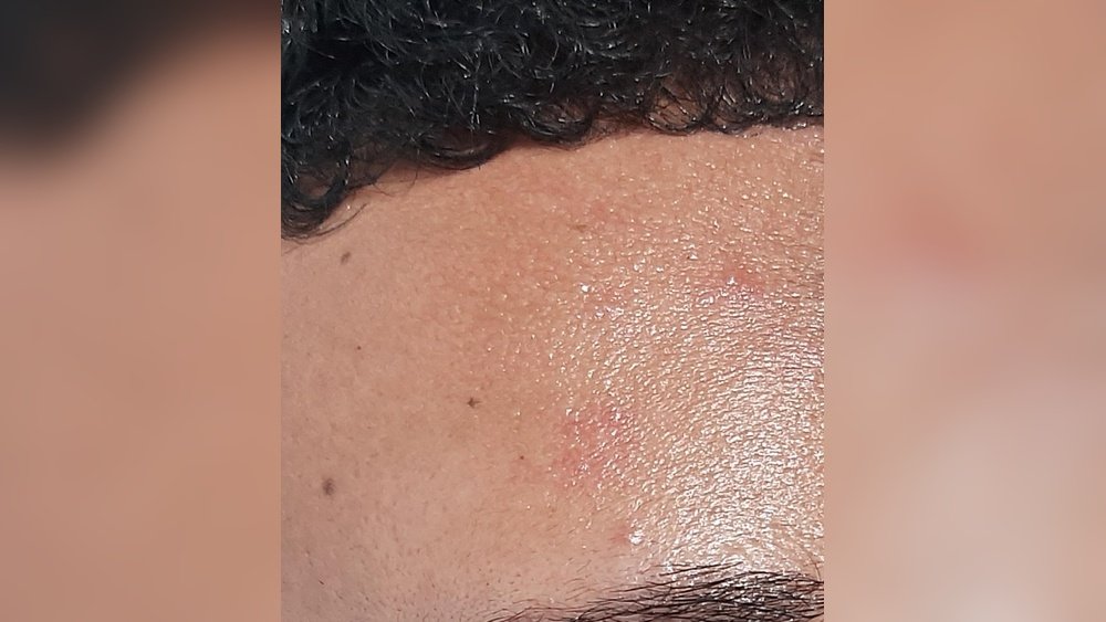 Why My Face Feels Waxy Texture